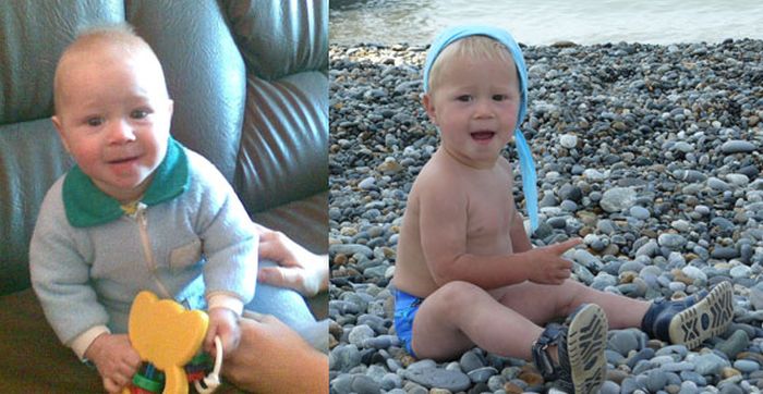 Дети до и после усыновления (54 фото)